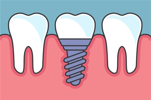 梦见满口牙掉吐在手上