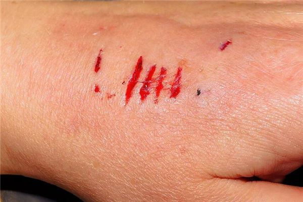 女人梦见左手流血